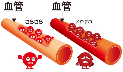 チューニングシリカイメージ２